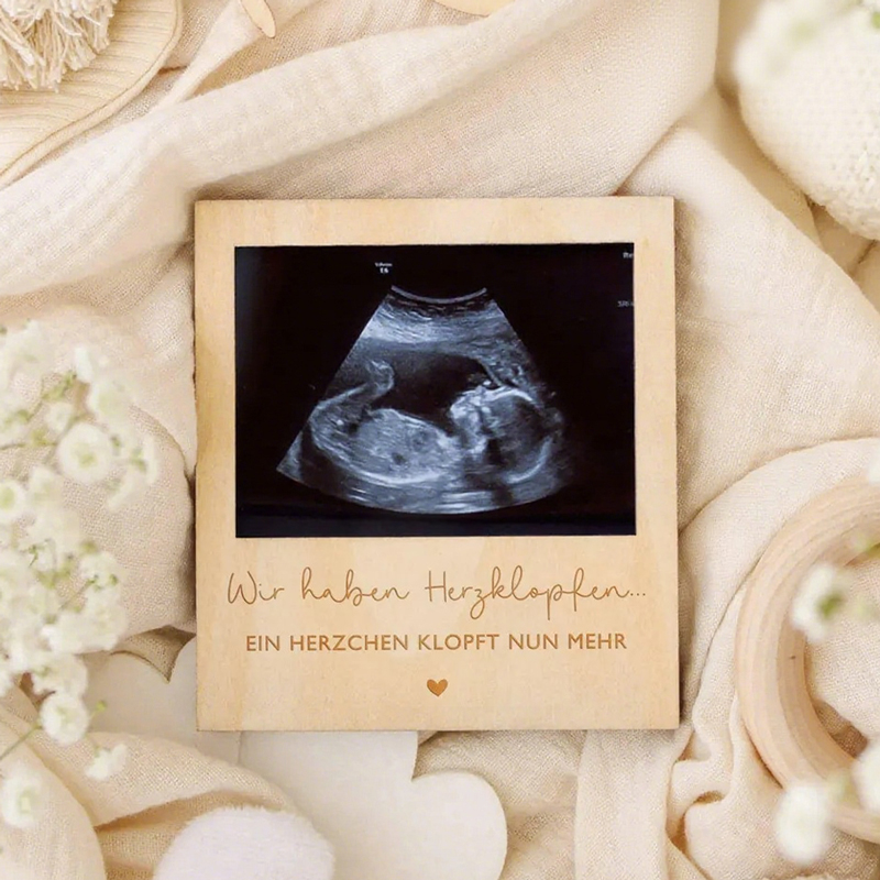 Ultrasound Pregnancy Announcem – Photo Booth Frame Bewertung und Preis